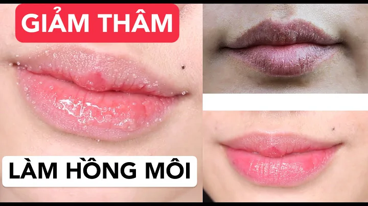 Top 10 cách môi hết thâm