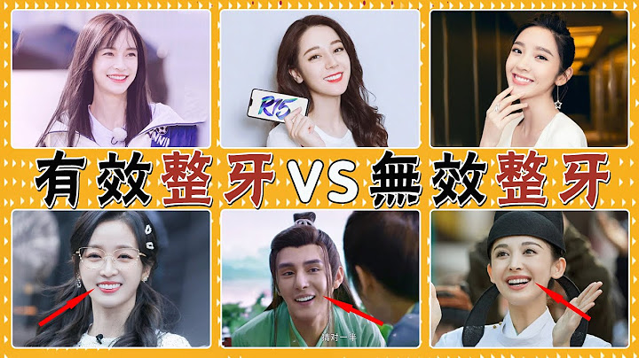 整牙如整容！有人換牙後美到認不出，有人秒變凸嘴怪#貴圈四姨太#陳希妍#李思思#楊冪#娜扎#陳瑤#楊穎#唐藝昕#吳宣儀#林允#馬思純#迪麗熱巴#吳昕#廖勁鋒#撲哧君#劉濤#張柏芝#趙麗穎#宋茜#烤瓷牙 - 天天要聞