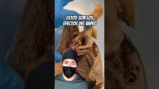 🚨🚨La realidad detrás del vapeo#medicine#cirugíageneral #vape#salud#bienestar#información#importante
