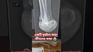x-ray , Bangladeshi Tesla accident 😭 #xray #ctscan #anatomy #fujifilm #mbbs #doctor #hospital