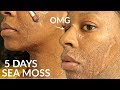 I Used SEA MOSS GEL on My FACE for 5 Days & WOW!!