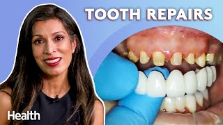 Periodontist Answers YOUR Questions About Abscesses, Missing Teeth, and Veneers | Ask An Expert