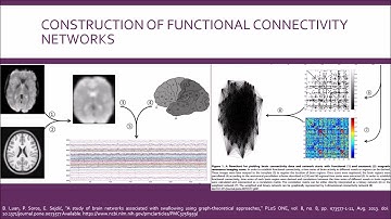 A study of brain networks associated with swallowing using graph-theoretical approaches