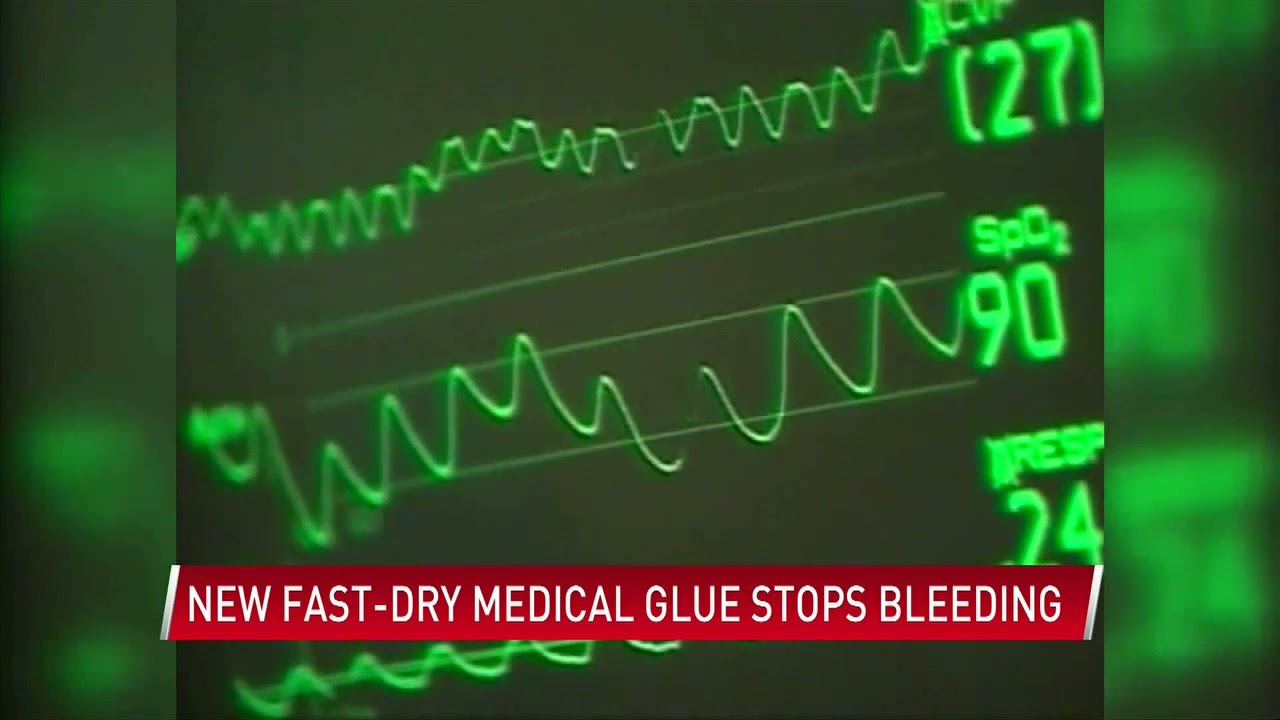 Medical glue inspired by barnacles stops bleeding in seconds YouTube