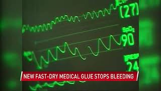 Medical glue inspired by barnacles stops bleeding in seconds
