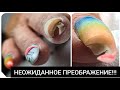 УБЕРИ это НЕМЕДЛЕННО ///  AGENT nail