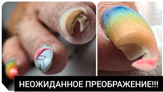 :    ///  AGENT nail