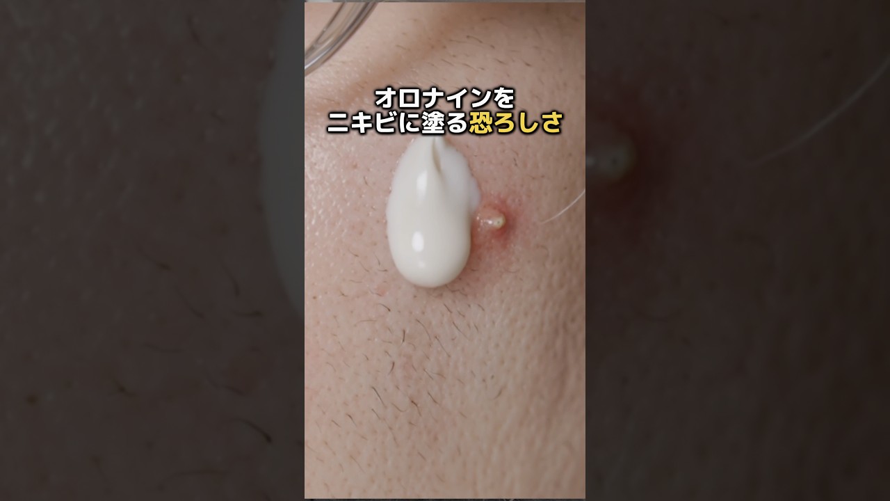 オロナインをニキビに塗る恐ろしさ