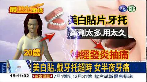 "美白贴"过头 妙龄女牙痛难眠 - 天天要闻