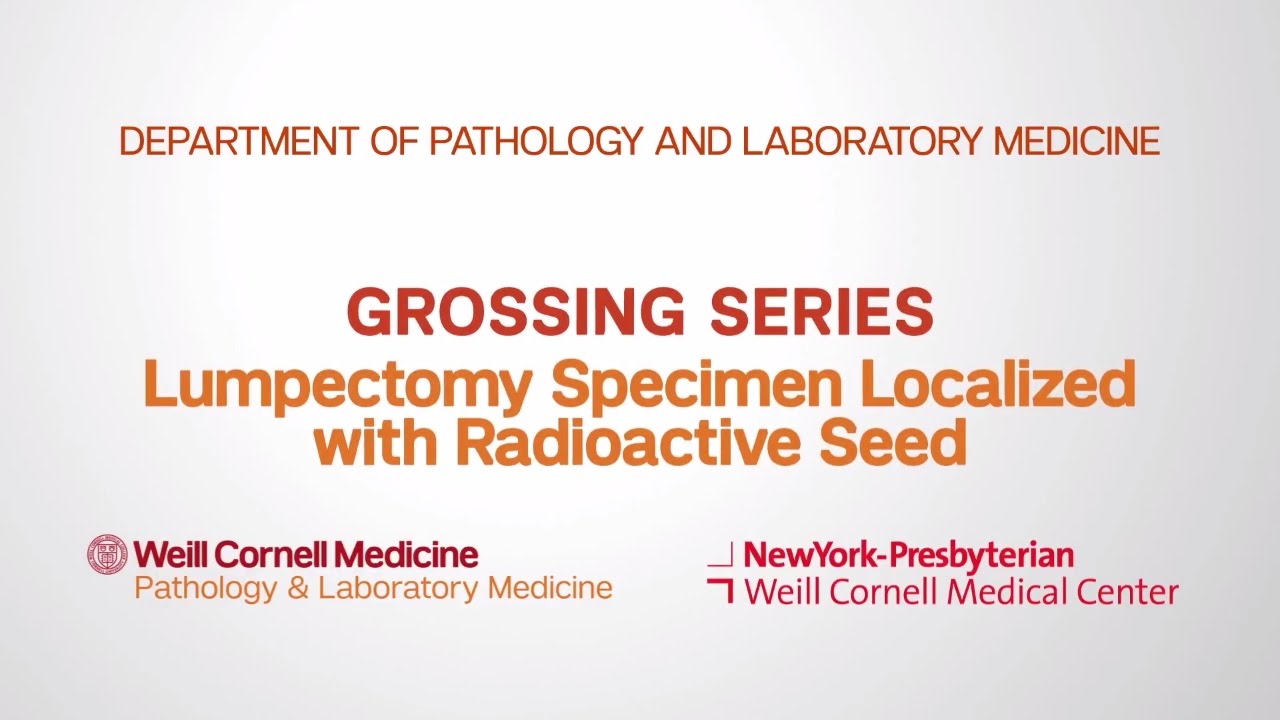 Grossing Breast Pathology Specimens Department of Pathology and