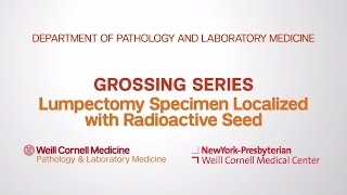Grossing Breast Pathology Specimens | Department of Pathology and Laboratory Medicine