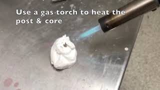 How to remove a Cast Post & Core from a dental crown