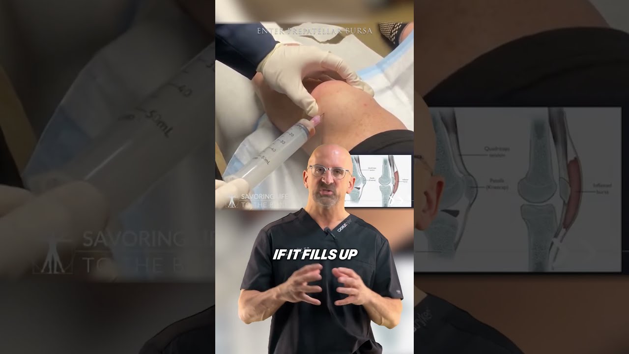 Quick Fix For Swollen Knee Shorts