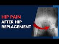 HIP PAIN after Hip Replacement Surgery