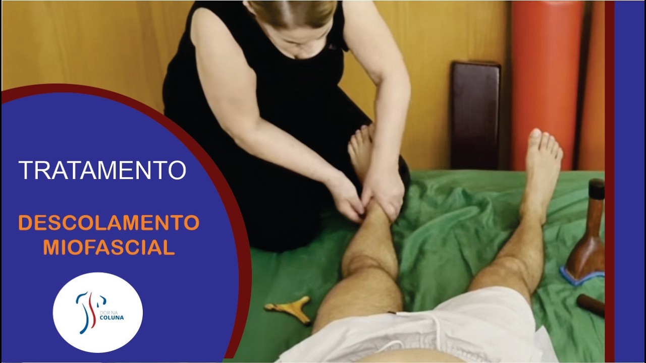 DESCOLAMENTO MIOFASCIAL
