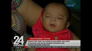 24 Oras: Premature baby na napakagaan noon, maluso matapos ang limang buwang gamutan