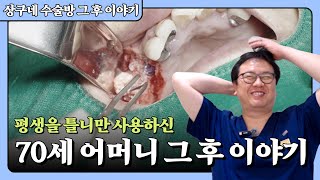 (Ep1-1)틀니로 씹기가 많이 불편하셨던 70세 어머니 그 후 이야기 | 구강악안면외과 전문의