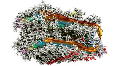 Curing the Aging Brain