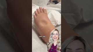 Doctor reacts: dent in her foot?!