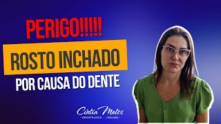 Alerta Rosto Inchado Por Causa Do Dente É Perigo O Que Fazer?