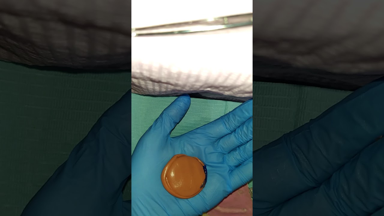 putty index - condensation silicon- عربي