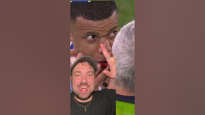 ASÍ QUEDO LA NARIZ DE MBAPPE. #futbol #francia #mbappe #EURO2024