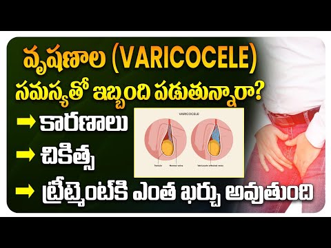 What is Varicocelectomy Surgery? || Best Treatment for Varicocele || How to Cure Varicocele