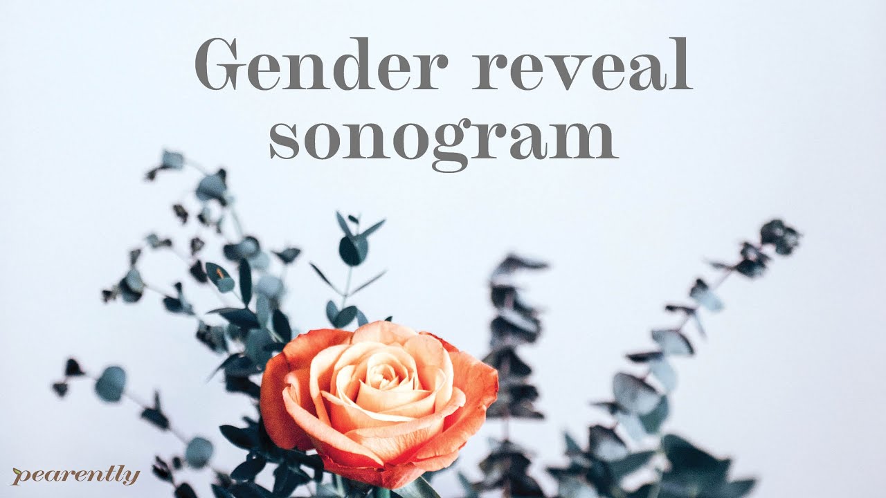 Gender Reveal Sonogram Level II Ultrasound YouTube
