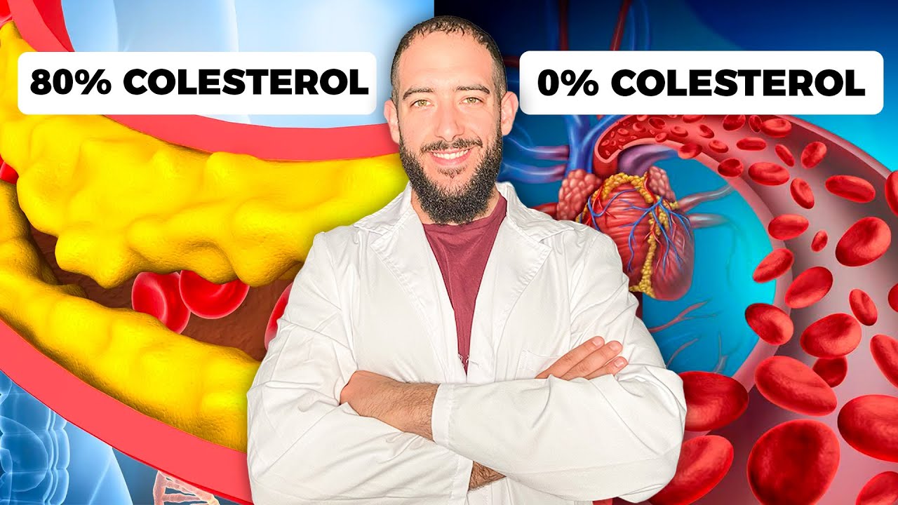 Arterias Limpias de Colesterol sin Tomar Estatinas: 3 Hábitos Sencillos