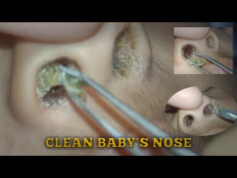 CLEAN BABY'S NOSE when baby is sleeping
