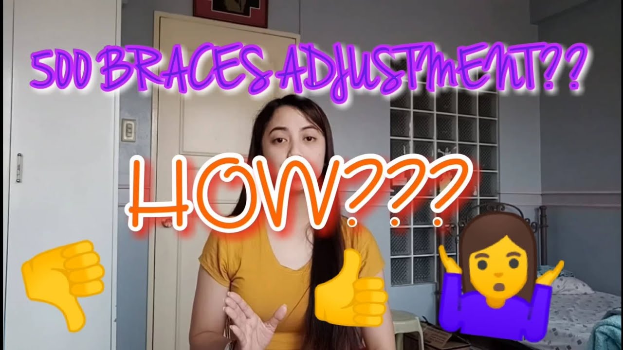 BRACES Q&A TIPS AND ADVICE BAKIT MURA LANG? YouTube