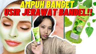 MASKER JERAWAT PALING AMPUH!!  || REVIEW MASKER JERAWAT SARIAYU 😱😱