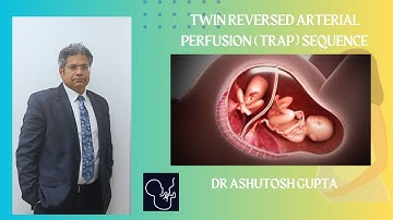 Twin reversed arterial perfusion (TRAP) sequence