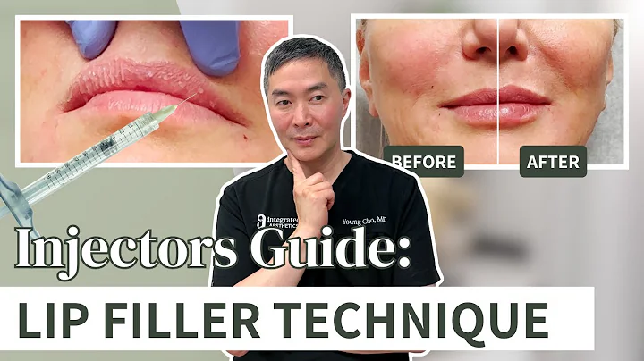 How to Create Beautiful Lips With Dermal Fillers | Injector’s Guide