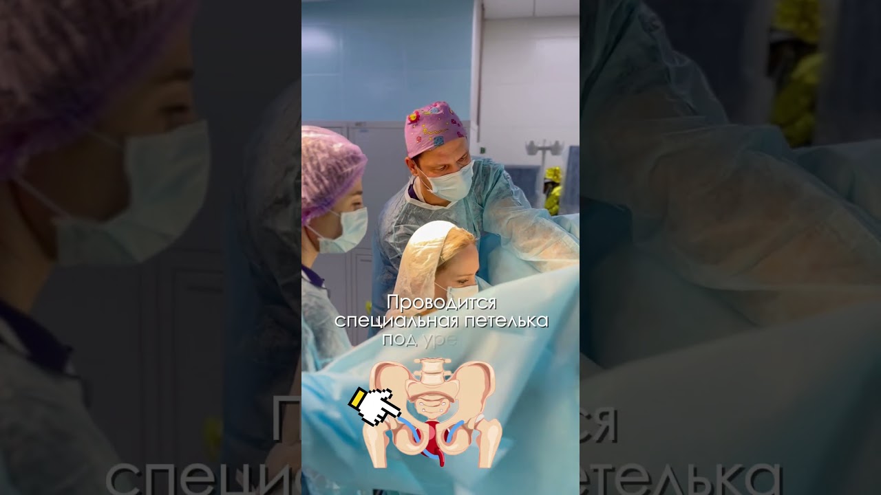 УРО-ГИНЕКОЛОГИЯ: ЛЕЧЕНИЕ СТРЕССОВОГО НЕДЕРЖАНИЯ МОЧИ #уролог #гинеколог #shorts