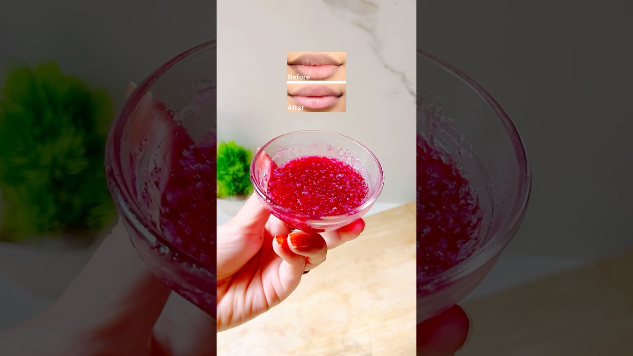 PIGMENTED LIPS gone in 2 weeks😍