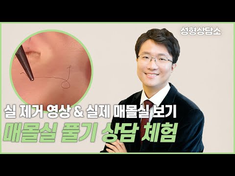 성형상담소 EP.3 💌 I 매몰실 풀기(쌍꺼풀 풀기)