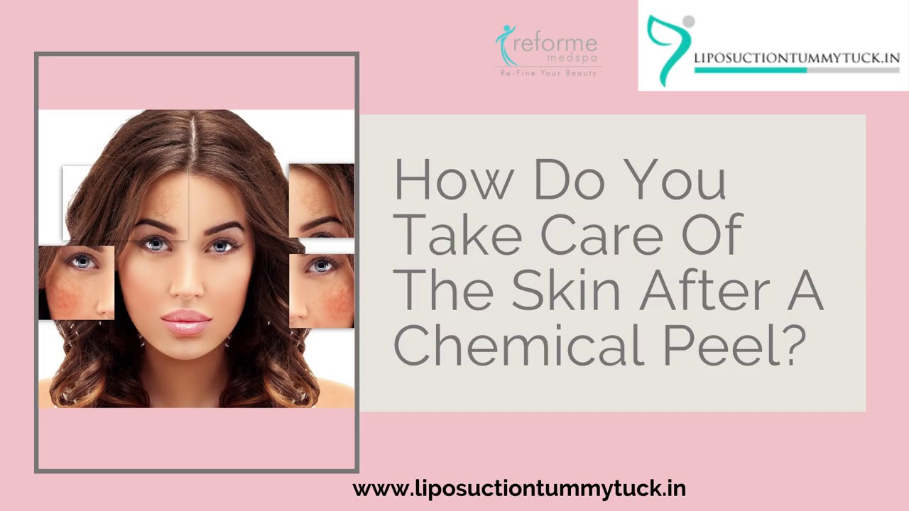 How Do You Take Care Of The Skin After A Chemical Peel Best Cosmetic Surgeon Dr Prashant