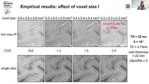 ISMRM 2020 directors cut Saskia Bollmann 1105