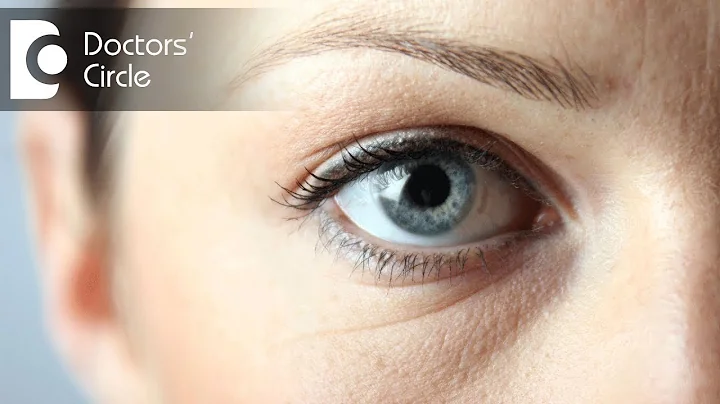 What causes dark spots in the white part of eyes? - Dr. Elankumaran P