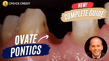 Ovate Pontics for Bridges - The Complete Guide with Dr Jason Smithson - PDP158