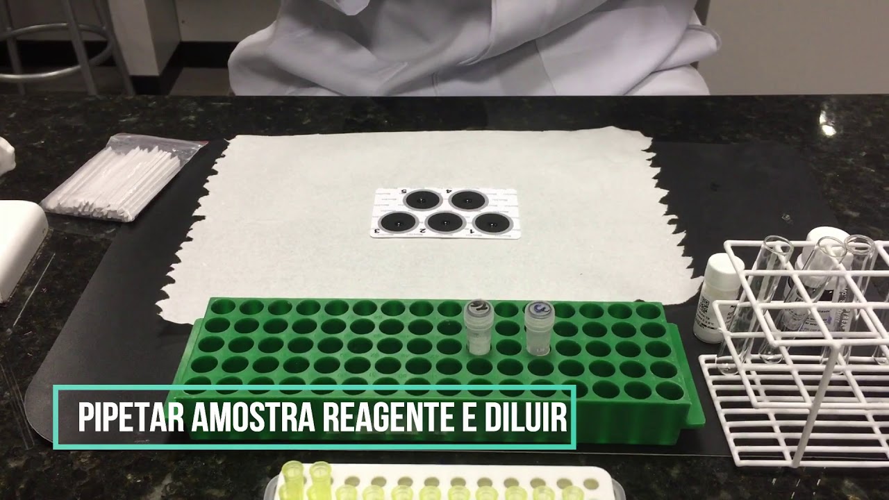 PCR PROTEINA C REATIVA YouTube PCR PROTEINA C REATIVA YouTube