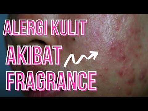 Sensitive Skin Reacts To Fragrance. How Bad Gonna Be The Skin Alergy ?