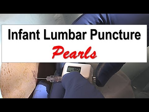 Infant Lumbar Puncture Pearls