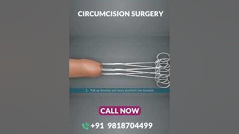 ZSR Circumcision Surgery in Delhi: A Step-by-Step Animated Guide | Circumcision Surgery Cost #shorts