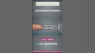 ZSR Circumcision Surgery in Delhi: A Step-by-Step Animated Guide | Circumcision Surgery Cost #shorts