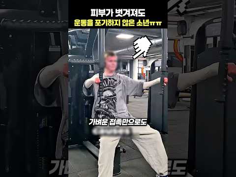 피부가 벗겨져도 운동을 포기하지 않은 소년ㅠㅠ