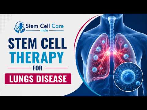 Stem Cell Therapy For Lungs Disease | Best Stem Cell Hospital In Delhi | Treatment For Lung Disease