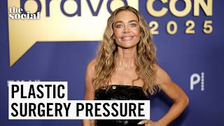 Famous Denise Richards’ Facelift is Causing Drama | The Social Wealth