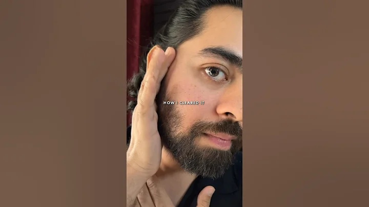 Oily Skincare Routine